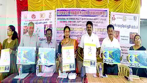 தொழுநோய் விழிப்புணர்வு போஸ்டரை நாமக்கல் மாவட்ட  தொழுநோய் பிரிவு இணை இயக்குனர் மருத்துவர் ஜெயந்தினி வெளியிட்ட காட்சி. அருகில் கபிலக்குறிச்சி ஊராட்சி மன்றத்தலைவர்  வடிவேலு, வேர்டு செயலாளர்  சிவகாமல்லி ஆகியோர் உள்ளனர்.