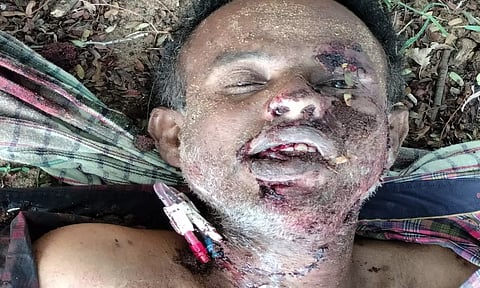 அடையாளம் தெரியாத சுமார் 50 வயது மதிக்கத்தக்க ஆண்&nbsp;