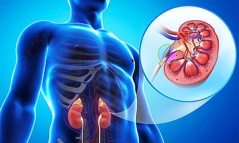 சிறுநீரக கற்களுக்கு ஓமியோபதி மருத்துவத்தில் சிறப்பு சிகிச்சை