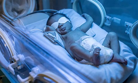 பச்சிளம் குழந்தைகளுக்கு மஞ்சள் நோய் ஏற்படுவதற்கான காரணங்கள் என்ன?