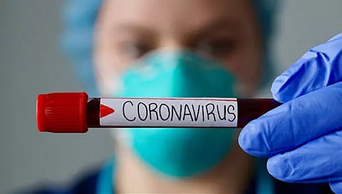 சேலத்தில் கொரோனாவுக்கு 20 பேர் பாதிப்பு