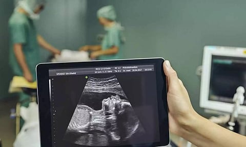 உலகில் முதல் முறையாக கருவில் இருக்கும் குழந்தைக்கு மூளை அறுவை சிகிச்சை- அமெரிக்க டாக்டர்கள் சாதனை