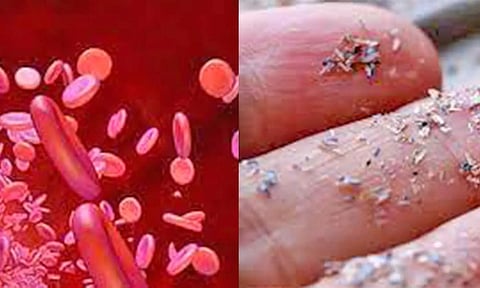 மனிதனின் ரத்தத்தில் பிளாஸ்டிக் நுண்துகள்கள் கண்டுபிடிப்பு