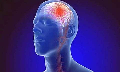 பக்கவாதத்தில் இருந்து மீள்வது எப்படி?