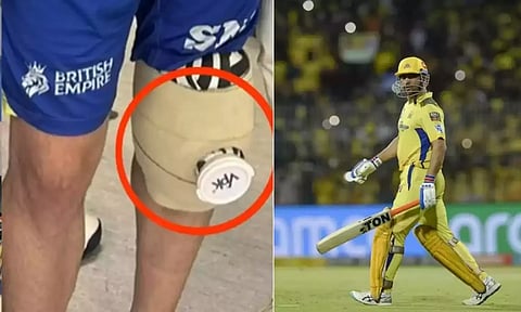 எம்.எஸ்.டோனிக்கு முழங்காலில் வெற்றிகரமாக நடந்து முடிந்த அறுவை சிகிச்சை