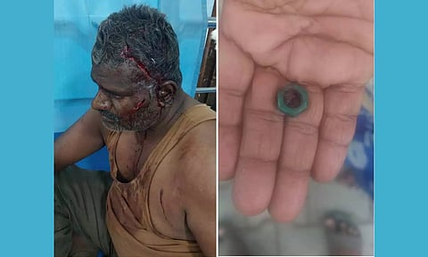 டிரைவர் கார்த்திகேயன், தலையில் இருந்து அகற்றப்பட்ட நட்டு.