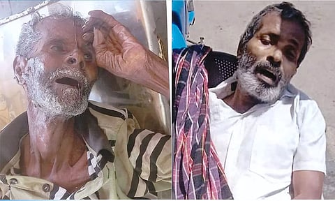 அடையாளம் தெரியாத ஆண் பிணங்கள்