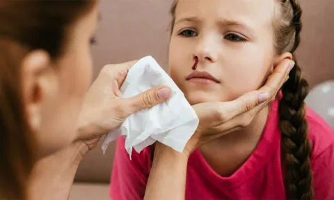 குழந்தைகளின் மூக்கில் ரத்தக்கசிவா?