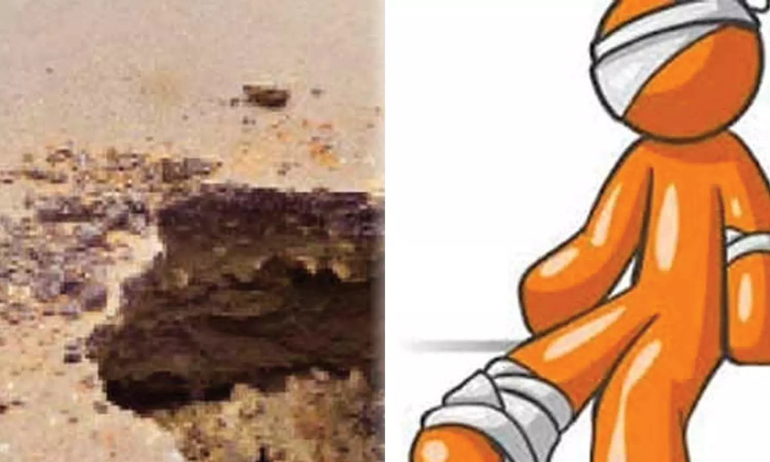 அங்கன்வாடி மையத்தில் சுற்றுச்சுவர் அமைக்க தோண்டிய பள்ளத்தில் விழுந்து சிறுமி படுகாயம்