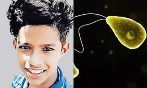 நீரில் வாழும் அமீபாவால் அபூர்வ மூளை தொற்று நோய்- சிறுவன் பலி