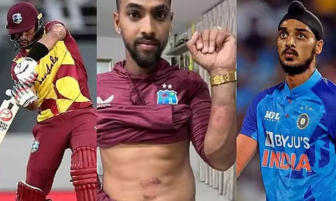 அடி கொடுத்த அர்ஷ்தீப் சிங் மற்றும் கிங்குக்கு நன்றி தெரிவித்த பூரன்- வைரலாகும் புகைப்படம்