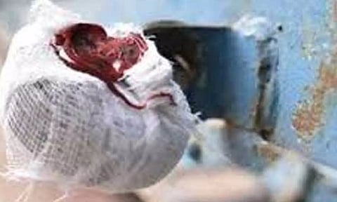 நோயாளிகளுக்கு சிகிச்சை அளித்த மருந்து கடைக்கு 'சீல்'