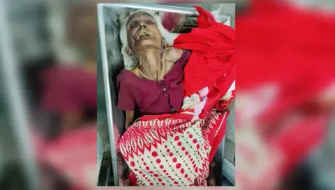 மூதாட்டி சிகிச்சை பலனின்றி சாவு