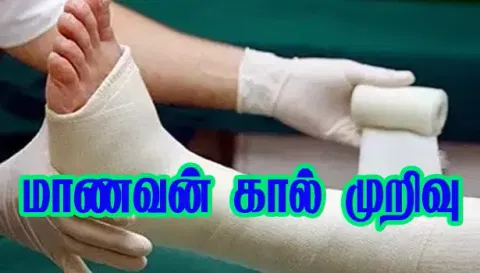 மாடியில் இருந்து தவறி விழுந்த மாணவன் கால் முறிவு