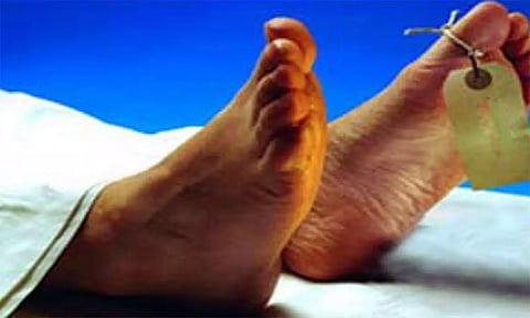 தீக்குளித்தவர் சிகிச்சை பலனின்றி பலி