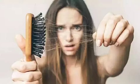 முடி உதிர்வு பிரச்சினையை தீர்க்கும் சின்னவெங்காயம்