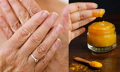 கைகளில் இருக்கும் சுருக்கம் நீங்க ஒரு சில டிப்ஸ்