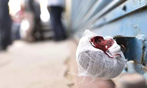 சுகாதாரமற்ற உணவு- 2 ஓட்டல்களுக்கு அதிகாரிகள் 'சீல்' வைப்பு