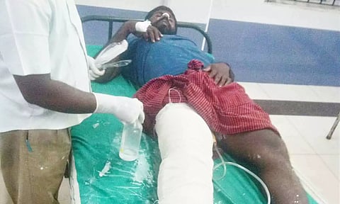 போலீசாரை வெட்டிவிட்டு பனை மரத்தில் ஏறி தப்ப முயன்ற தொழிலாளிக்கு கால் முறிந்தது