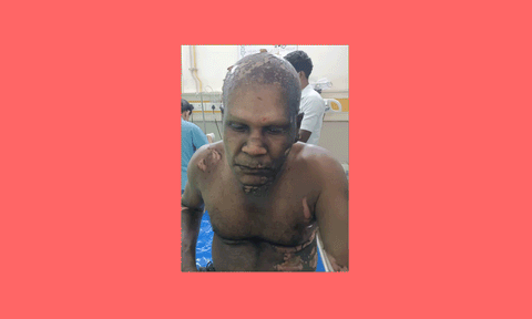 மின்சாரம் தாக்கியதில் மின் ஊழியர் படுகாயம்