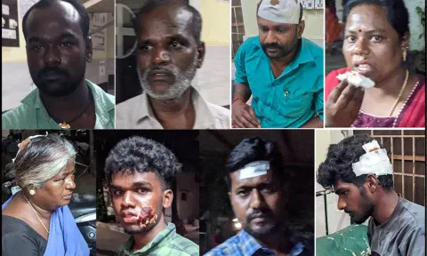தாக்குதலில் காயமடைந்தவர்களுக்கு சிகிச்சை அளிக்கப்பட்டது.