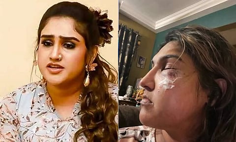நடிகை வனிதா மீது மர்ம நபர் திடீர் தாக்குதல்: காயத்துடன் புகைப்படம் வெளியிட்டதால் பரபரப்பு