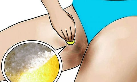 தொடை இடுக்கின் கருமையை நீக்கும் வழிகள்