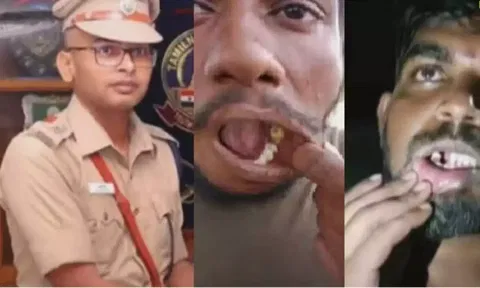 பல் பிடுங்கிய விவகாரம்: போலீஸ் அதிகாரி பல்வீர்சிங் உள்பட 14 பேர் கோர்ட்டில் ஆஜர்