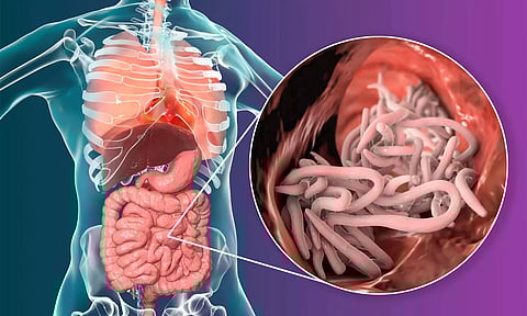 குடற்புழுக்களை ஒழிக்கும் இயற்கை வழிமுறைகள்
