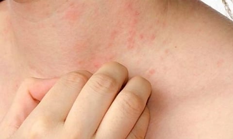 அரிப்பு ஏற்பட்டால் ஆராயுங்கள்...!