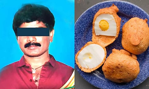 முட்டை பஜ்ஜி சாப்பிட்ட வாலிபருக்கு ஏற்பட்ட விபரீதம்