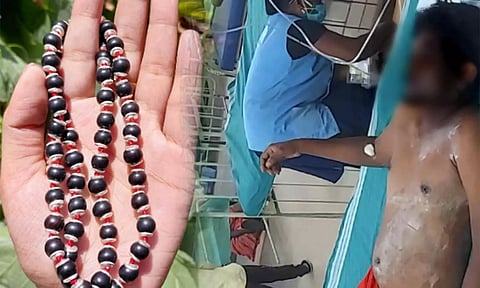 கருங்காலி மாலை வாங்க சென்ற வாலிபர் மீது ஆசிட் வீச்சு