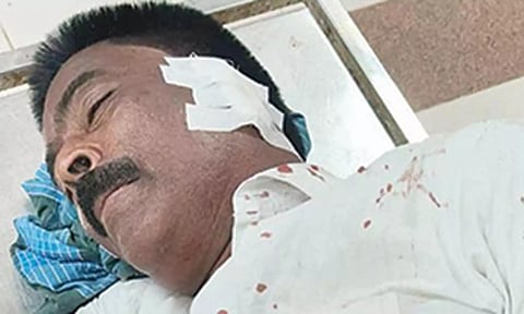 ஊராட்சி தலைவியின் கணவர் காதை கடித்து துப்பிய ஆட்டோ டிரைவர்