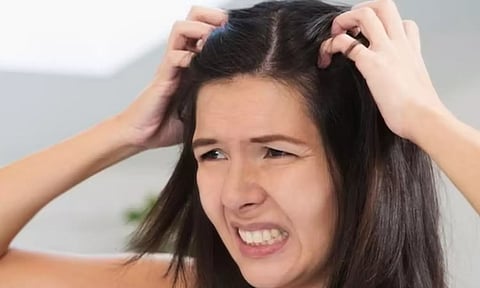 இந்த ஒரு எண்ணெய் போதும், பொடுகுத்தொல்லை இனி இல்லவே இல்லை...!