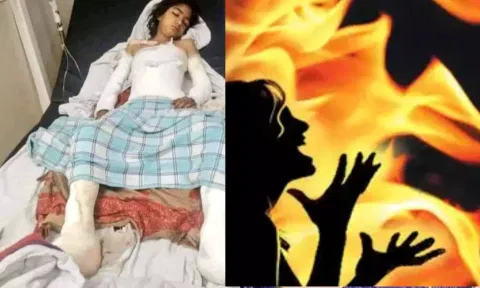 காது கேளாத வாய் பேச முடியாத பழங்குடியின சிறுமி தீவைத்துக் கொலை.. நடவடிக்கை எடுக்காத காவல்துறை