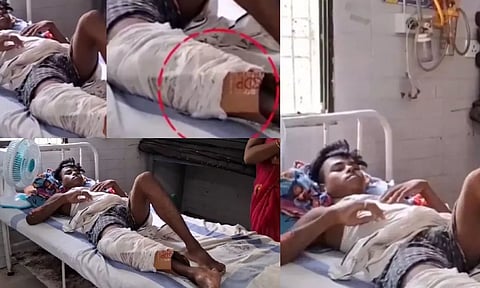 விபத்தில் காயமடைந்தவருக்கு அட்டைப் பெட்டியில்  கட்டுப் போட்ட அரசு மருத்துவமனை - வைரல் வீடியோ