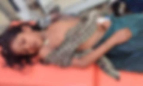 பள்ளி மேற்கூரை இடிந்து விழுந்து மாணவி படுகாயம்