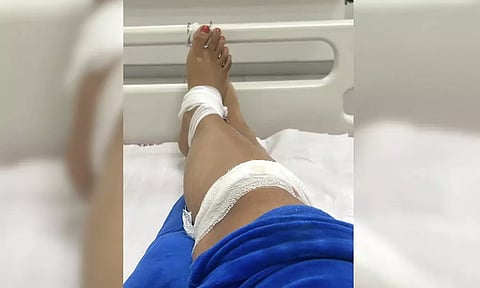 ரேபிடோவில் சென்று நூலிழையில் உயிர்தப்பிய சாஃப்ட்வேர் எஞ்சினியர்.. வைரல் சம்பவம்