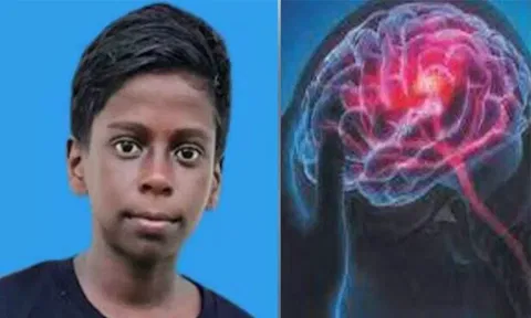 கேரளாவில் அமீபிக் மூளைக்காய்ச்சலுக்கு மேலும் ஒரு மாணவன் உயிரிழப்பு