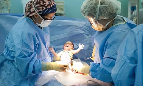 பிரசவத்தில் சிசேரியன் இறுதி நிமிடங்களில் தீர்மானிக்கப்படுகிறதா?