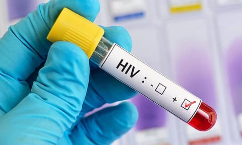 800-க்கும் மேற்பட்டோருக்கு எச்ஐவி பாதிப்பு: எல்லோரும் பள்ளி, கல்லூரி மாணவர்கள்.. அதிர்ச்சி