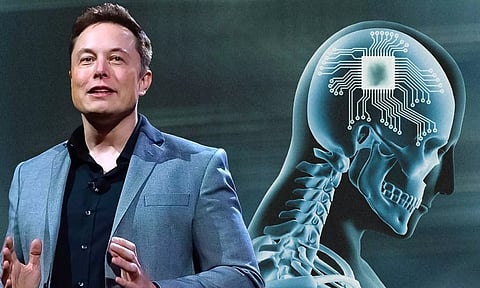 மனித மூளையில் சிப் - அடுத்தக்கட்டத்திற்கு ரெடியான எலான் மஸ்க்..!