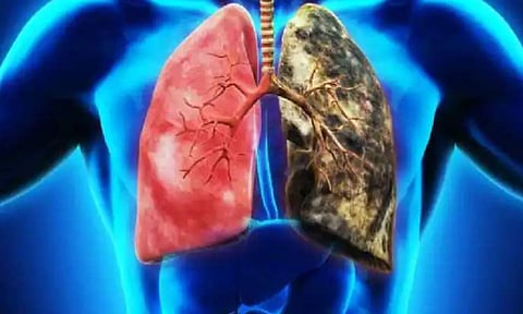 கொசுவர்த்தியினால் ஏற்படும் நுரையீரல் பாதிப்பு: எச்சரிக்கும் மருத்துவ நிபுணர்கள்