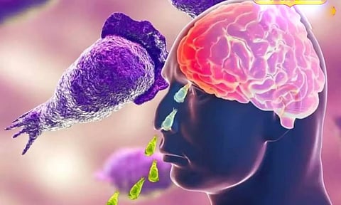 கேரளாவில் அமீபிக் மூளைக்காய்ச்சலுக்கு மேலும் ஒரு சிறுவன் பாதிப்பு