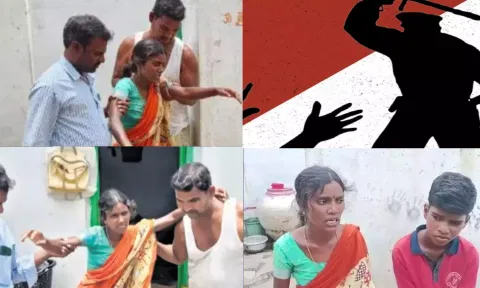 திருட்டு வழக்கில் தலித் பெண்ணுக்கு போலீஸ் ஸ்டேஷனில் சித்ரவதை.. காலை உடைத்த கொடூரம்