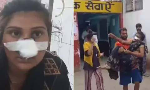 பிறந்த வீட்டுக்கு போக அடம்பிடித்த மனைவியின் மூக்கை அறுத்த கணவன்