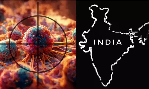 இந்தியாவில் தொடர்ந்து அதிகரிக்கும் புற்றுநோய் மரணங்கள்-  எச்சரிக்கும் ஐ.சி.எம்.ஆர்.