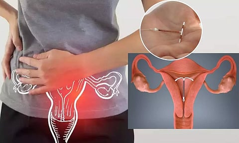 காப்பர்டி பயன்படுத்துவதால் ஏற்படும் நன்மை-தீமைகள்