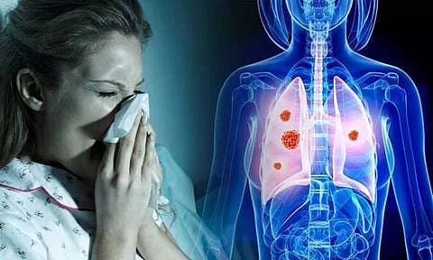 சளி எப்படி உருவாகிறது... சளி பிடிக்காமல் இருக்க என்ன செய்யலாம்?