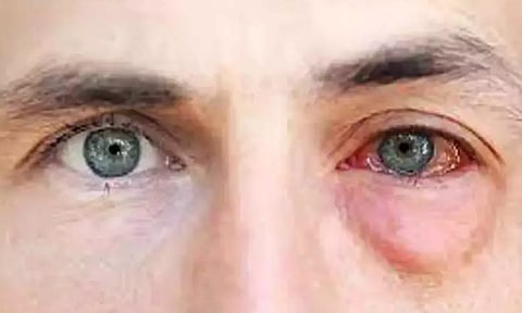 அதிக நேரம் கணினியை பார்ப்பவரா நீங்கள்? உங்களுக்கான அருமையான டிப்ஸ்....